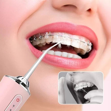 HydroClean Pro - Irrigador dental portatil